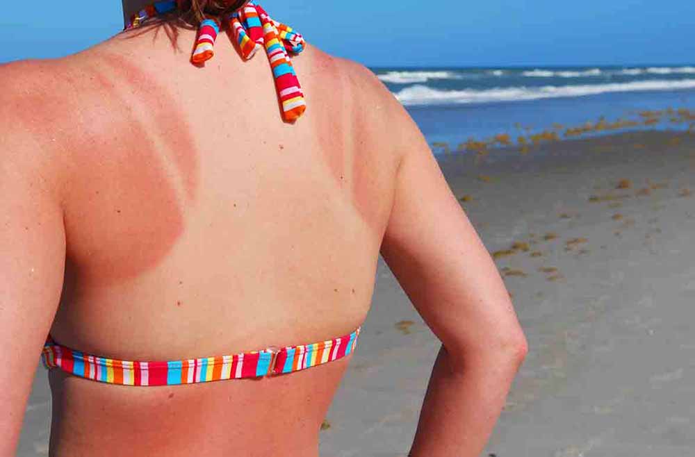 Cara memilih dan memakai sunscreen dengan benar