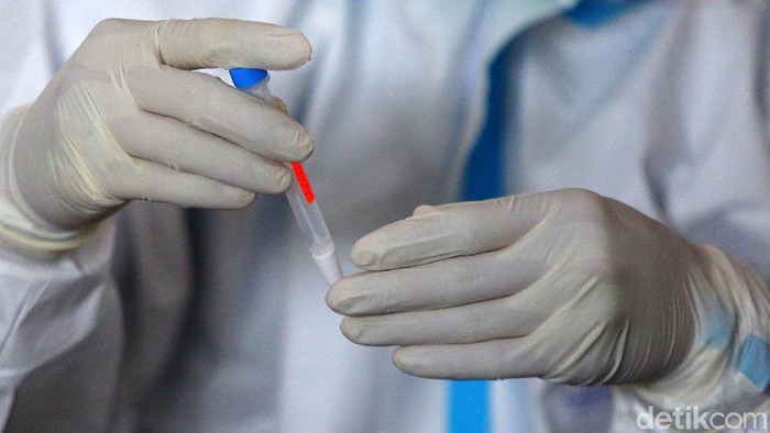 Jadi Syarat Liburan Akhir Tahun! Ini 10 Tempat Rapid Test Antigen di Jabodetabek