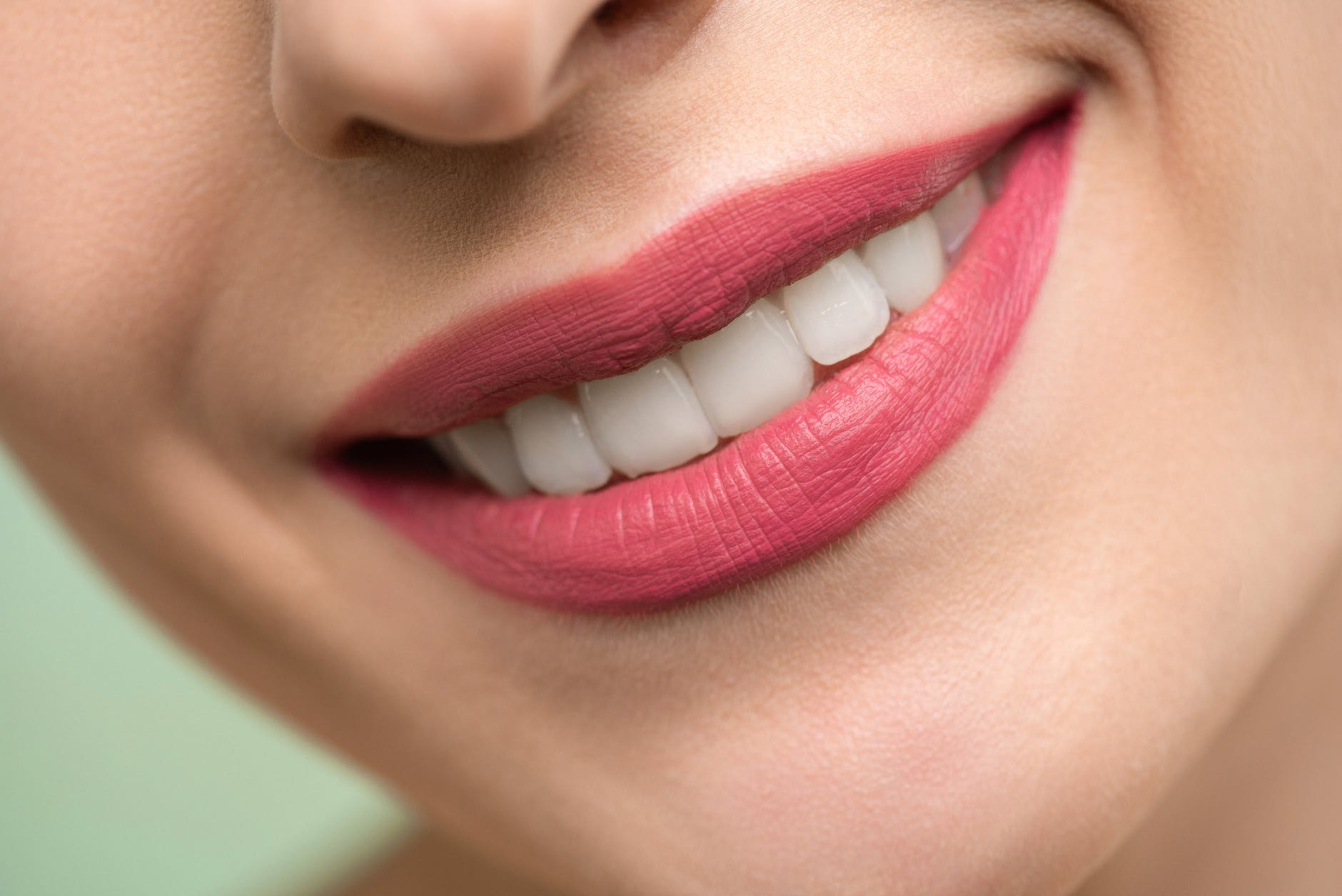 5 Penyebab Karang Gigi dan Cara Mencegahnya, Jangan Sepelekan!