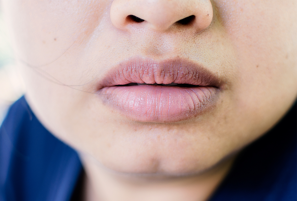 11 Cara Menghilangkan Bibir Hitam dengan Mudah | Bisa Pakai Bahan Alami