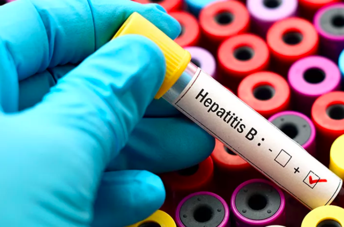 Dapat Menular, Kenali Gejala Hepatitis B dan Cara Pengobatannya