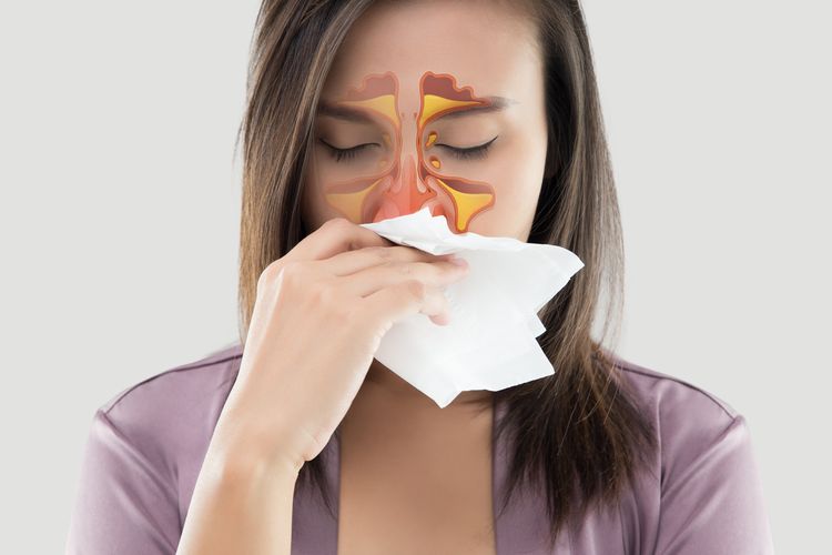 7 Cara Mengobati Sinusitis yang Bisa Dilakukan di Rumah dengan Alami