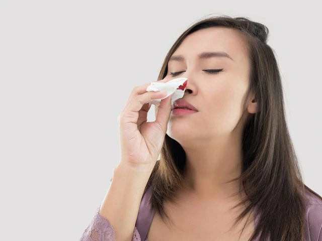 Kenali 5 Penyebab Mimisan Pada Lubang Hidung Sebelah Kiri