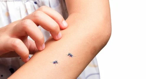 Menghilangkan Bekas Gigitan Nyamuk | Jangan Lakukan yang Ini!